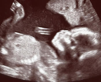 Hello Beautiful Baby Girl