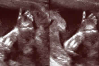 Baby's hand