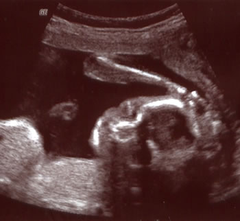 Baby Number Nine With Hands Up